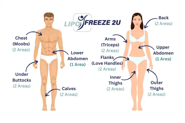 Areas you can have fat freezing treatment Abingdon-on-Thames