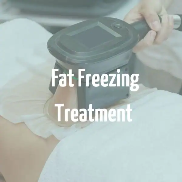 fat freezing treatment Abingdon-on-Thames
