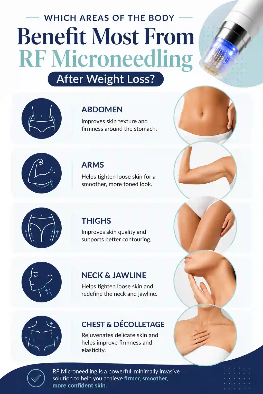 Which Areas of the Body Benefit Most From RF Microneedling After Weight Loss Abingdon-on-Thames